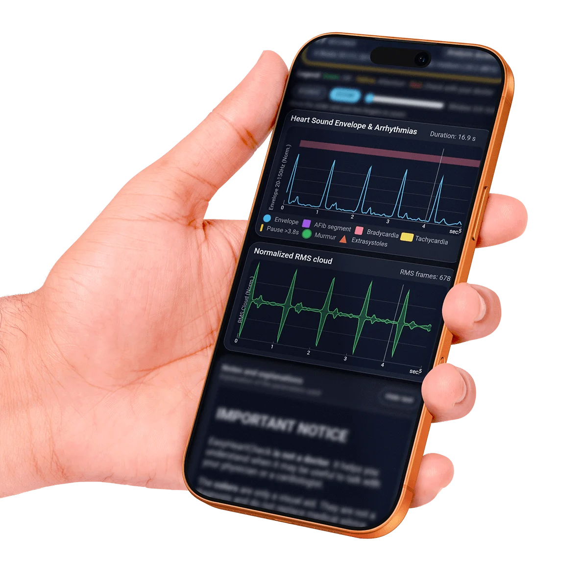 Grafici del battito cardiaco visualizzati nel report Easy Heart Check